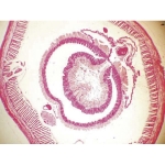 Earthworm slide set of 6